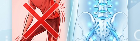 o que não fazer com o nervo ciático inflamado e o que fazer para aliviar a dor e a inflamação